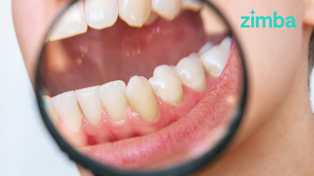 Unmasking Plaque