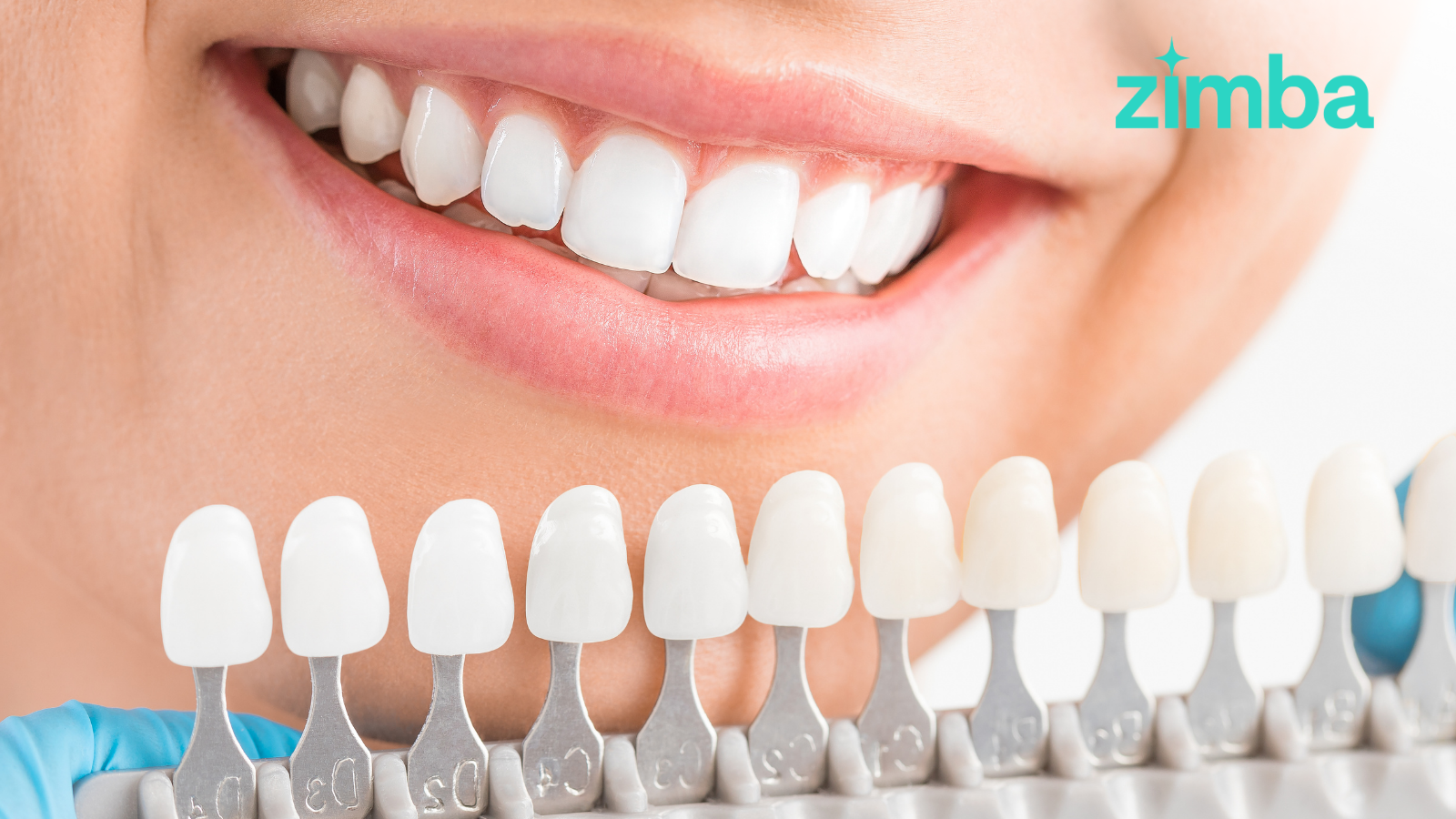 Professional Teeth Whitening: Is It Worth The Price?